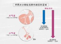 obstruct和block-obstruct和inhibit的区别