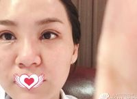 [整样]怎样交医疗保险