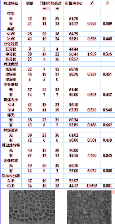 包含txnip蛋白的词条