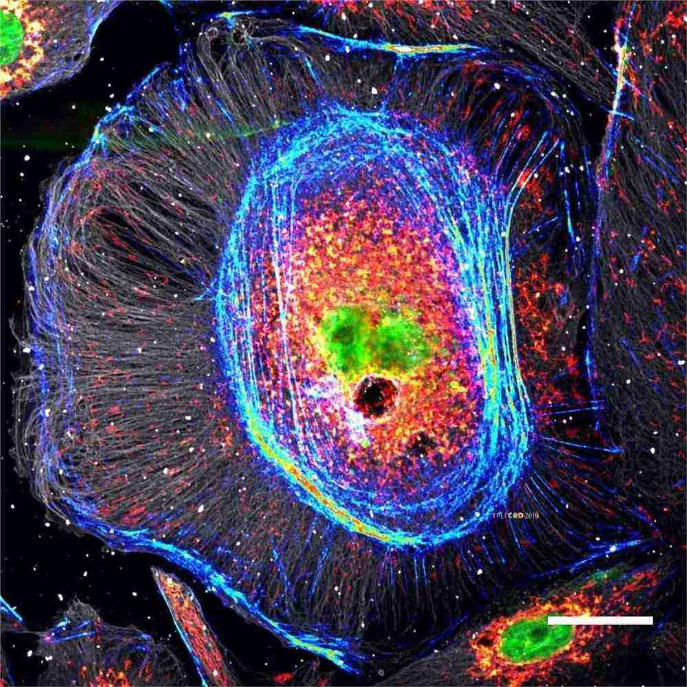 包含microscope怎么记忆的词条